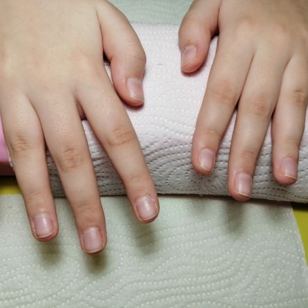 Gēla nagu pieaudzēšana