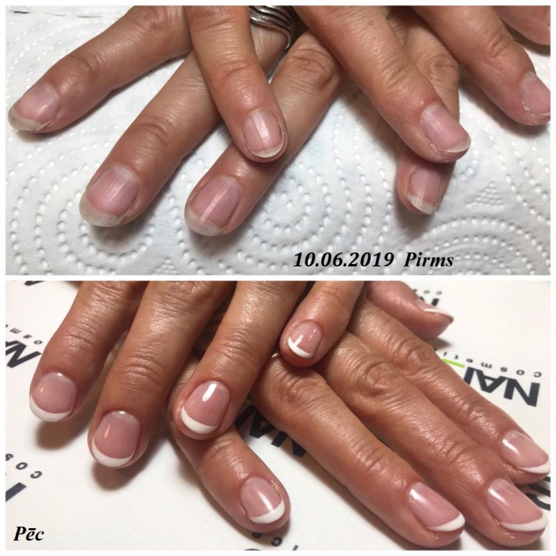 Gēllakas pārklājums-french