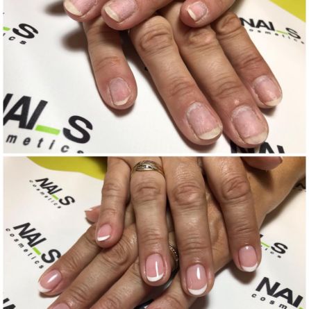 Gēllakas pārklājums-french