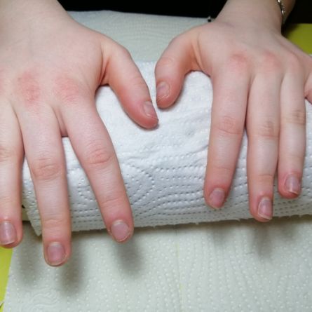 Nagu pieaudzēšana uz tipšiem